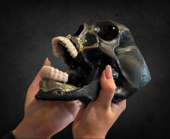 Implantacios protetika